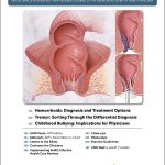 Hemorrhoids Horror Healed Review – Treatment For Hemorrhoids!!