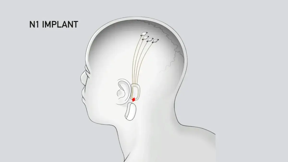 Illustration depicting the seamless integration of Neuralink's brain chip.