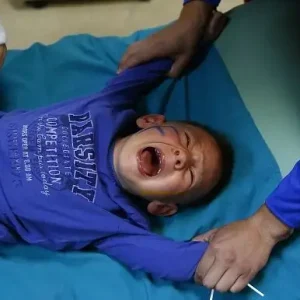 Sunat Laser: Manfaat dan Kelebihannya Dibanding Sunat Biasa